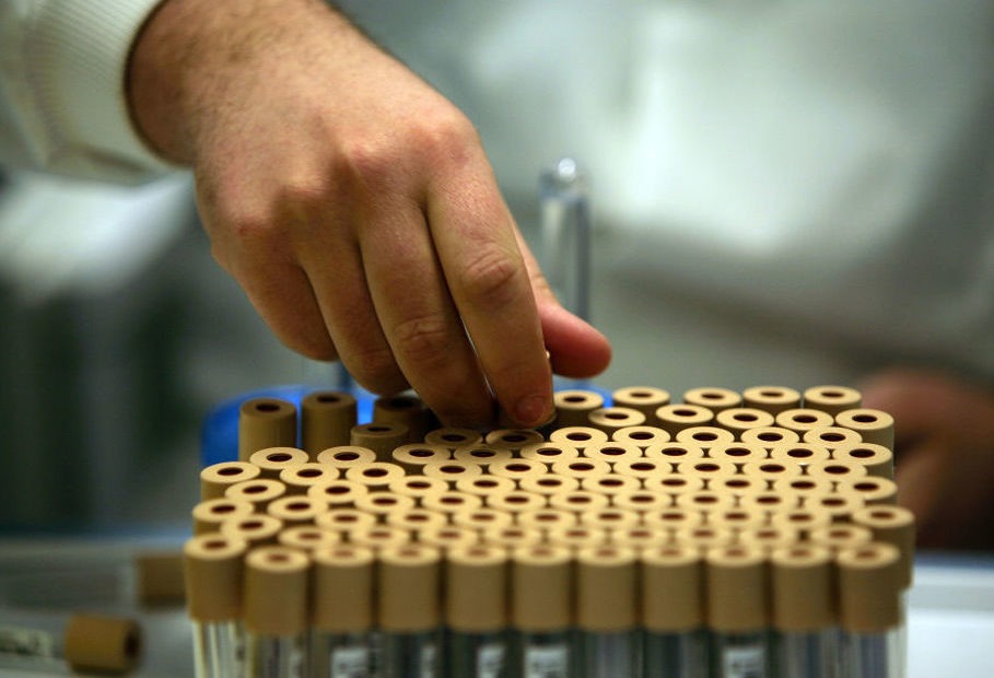 Researchers looked for genetic variants linked to sexual behavior in new genetic research that analyzed DNA from donated blood samples from nearly half a million middle-aged people from Britain who participated in a project called the UK Biobank. CREDIT: Christopher Furlong/Getty Images